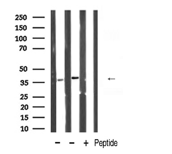 POLB / DNA Polymerase Beta Antibody - Western blot analysis of POLB expression in various lysates