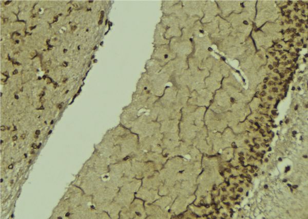 POLB / DNA Polymerase Beta Antibody - 1:100 staining mouse brain tissue by IHC-P. The sample was formaldehyde fixed and a heat mediated antigen retrieval step in citrate buffer was performed. The sample was then blocked and incubated with the antibody for 1.5 hours at 22°C. An HRP conjugated goat anti-rabbit antibody was used as the secondary.