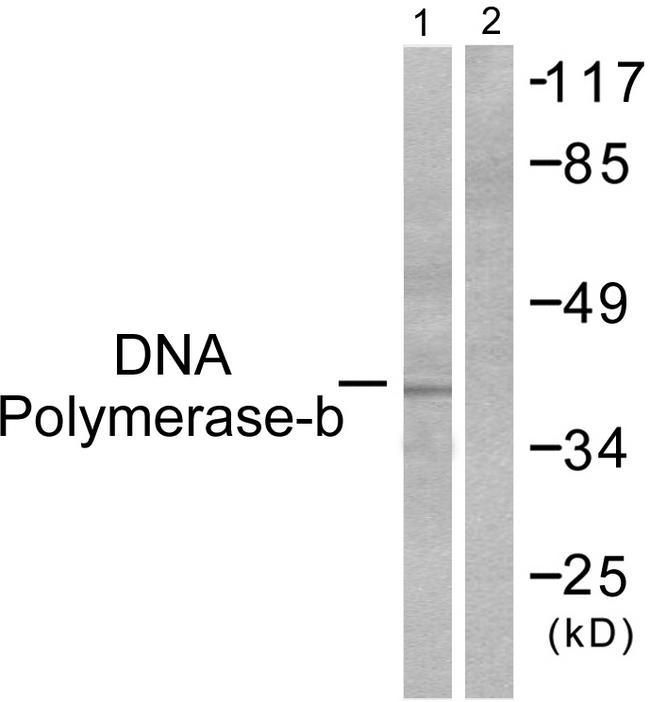 POLB / DNA Polymerase Beta Antibody - Western blot analysis of extracts from NIH/3T3 cells, using DNA Polymerase ß antibody.