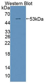 POLD1 Antibody - Western blot of POLD1 antibody.