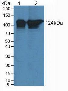 POLD1 Antibody - Western Blot; Sample: Lane1: Human Jurkat cells; Lane2: Human Hela cells.