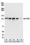 POLD1 Antibody - Detection of Human and Mouse PolD1 by Western Blot. Samples: Whole cell lysate (50 ug) from HeLa, 293T, Jurkat, mouse TCMK-1, and mouse NIH3T3 cells. Antibodies: Affinity purified rabbit anti-PolD1 antibody used for WB at 0.1 ug/ml. Detection: Chemiluminescence with an exposure time of 10 seconds.