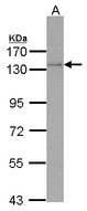 POLD1 Antibody - Sample (30 ug of whole cell lysate). A: Molt-4 . 7.5% SDS PAGE. POLD1 antibody diluted at 1:3000.