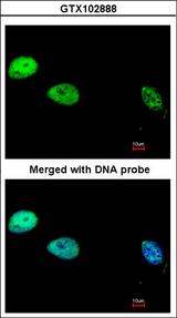 POLD1 Antibody - Immunofluorescence of paraformaldehyde-fixed HeLa using DNA Polymerase delta, catalytic subunit antibody at 1:200 dilution.