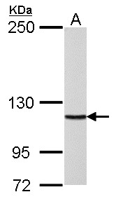 POLD1 Antibody - DNA polymerase delta antibody detects POLD1 protein by Western blot analysis. A. 30 ug Rat2 whole cell lysate/extract. 5 % SDS-PAGE. DNA polymerase delta antibody dilution:1:1000
