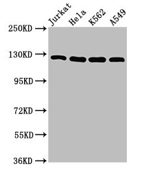 POLD1 Antibody - Western Blot Positive WB detected in: Jurkat whole cell lysate, Hela whole cell lysate, K562 whole cell lysate, A549 whole cell lysate All lanes: POLD1 antibody at 5µg/ml Secondary Goat polyclonal to rabbit IgG at 1/50000 dilution Predicted band size: 124 kDa Observed band size: 124 kDa