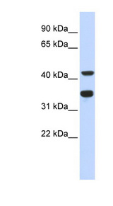 POLD2 Antibody - POLD2 antibody Western blot of Fetal Heart lysate. This image was taken for the unconjugated form of this product. Other forms have not been tested.