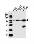 POLD2 Antibody - Western blot of lysates from HeLa, HepG2 cell line, mouse liver and rat liver tissue lysate (from left to right) with POLD2 Antibody. Antibody was diluted at 1:1000 at each lane. A goat anti-rabbit IgG H&L (HRP) at 1:5000 dilution was used as the secondary antibody. Lysates at 35 ug per lane.