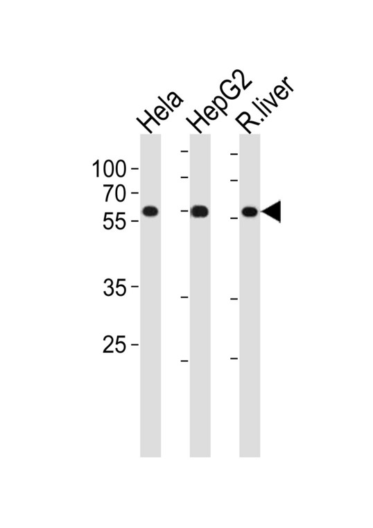 POLD2 Antibody - POLD2 Antibody western blot of HeLa,HepG2 cell line and rat liver tissue lysates (35 ug/lane). The POLD2 antibody detected the POLD2 protein (arrow).