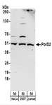 POLD2 Antibody - Detection of Human PolD2 by Western Blot. Samples: Whole cell lysate (50 ug) from HeLa, 293T, and Jurkat cells. Antibodies: Affinity purified rabbit anti-PolD2 antibody used for WB at 0.4 ug/ml. Detection: Chemiluminescence with an exposure time of 3 minutes.