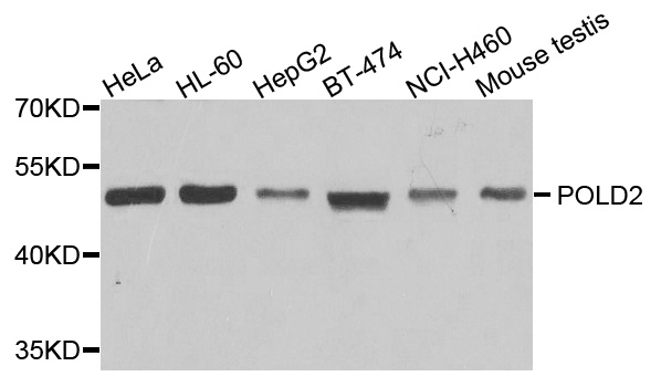 POLD2 Antibody - Western blot analysis of extracts of various cells.