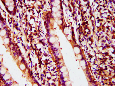 POLD2 Antibody - Immunohistochemistry image at a dilution of 1:400 and staining in paraffin-embedded human small intestine tissue performed on a Leica BondTM system. After dewaxing and hydration, antigen retrieval was mediated by high pressure in a citrate buffer (pH 6.0) . Section was blocked with 10% normal goat serum 30min at RT. Then primary antibody (1% BSA) was incubated at 4 °C overnight. The primary is detected by a biotinylated secondary antibody and visualized using an HRP conjugated SP system.