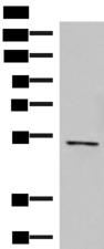 POLD2 Antibody - Western blot analysis of Jurkat cell lysate  using POLD2 Polyclonal Antibody at dilution of 1:800