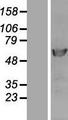 POLD2 Protein - Western validation with an anti-DDK antibody * L: Control HEK293 lysate R: Over-expression lysate