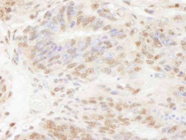 POLD3 Antibody - Detection of Mouse PolD3/p66 by Immunohistochemistry. Sample: FFPE section of mouse teratoma. Antibody: Affinity purified rabbit anti-PolD3/p66 used at a dilution of 1:250.