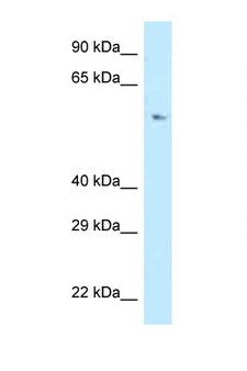 POLD3 Antibody - POLD3 / p66 antibody Western blot of Jurkat Cell lysate. Antibody concentration 1 ug/ml.  This image was taken for the unconjugated form of this product. Other forms have not been tested.