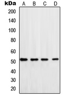 POLD3 Antibody - Western blot analysis of DNA Polymerase delta 3 expression in HeLa (A); MCF7 (B); Jurkat (C); mouse brain (D) whole cell lysates.