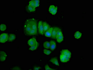 POLD3 Antibody - Immunofluorescence staining of MCF-7 cells with POLD3 Antibody at 1:100, counter-stained with DAPI. The cells were fixed in 4% formaldehyde, permeabilized using 0.2% Triton X-100 and blocked in 10% normal Goat Serum. The cells were then incubated with the antibody overnight at 4°C. The secondary antibody was Alexa Fluor 488-congugated AffiniPure Goat Anti-Rabbit IgG(H+L).