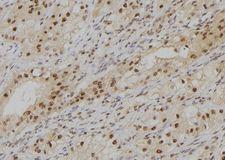POLD4 Antibody - 1:100 staining human kidney tissue by IHC-P. The sample was formaldehyde fixed and a heat mediated antigen retrieval step in citrate buffer was performed. The sample was then blocked and incubated with the antibody for 1.5 hours at 22°C. An HRP conjugated goat anti-rabbit antibody was used as the secondary.