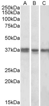 POLDIP2 / PDIP38 Antibody - Goat Anti-POLDIP2 Antibody (1µg/ml) staining of K562 (A), MCF7 (B) and Mouse Liver (C) lysates (35µg protein in RIPA buffer). Primary incubation was overnight at 4C. Detected by chemiluminescencence.