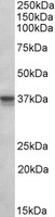 POLDIP2 / PDIP38 Antibody - POLDIP2 antibody (1 ug/ml) staining of MCF7 lysate (35 ug protein/ml in RIPA buffer). Primary incubation was 1 hour. Detected by chemiluminescence.