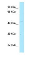 POLDIP2 / PDIP38 Antibody - POLDIP2 / PDIP38 antibody Western Blot of Fetal kidney.  This image was taken for the unconjugated form of this product. Other forms have not been tested.