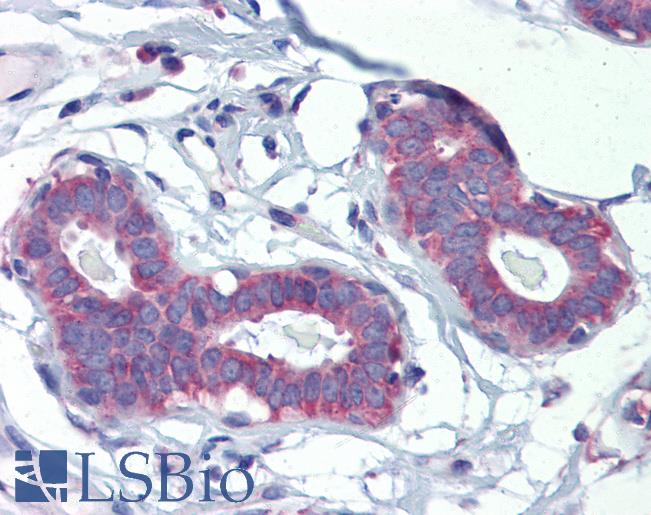 POLDIP3 / p46 Antibody - Human Breast (formalin-fixed, paraffin-embedded) stained with POLDIP3 antibody LS-B3543 followed by biotinylated goat anti-rabbit IgG secondary antibody, alkaline phosphatase-streptavidin and chromogen.  This image was taken for the unconjugated form of this product. Other forms have not been tested.