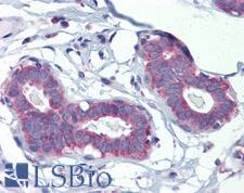 POLDIP3 / p46 Antibody - Human Breast (formalin-fixed, paraffin-embedded) stained with POLDIP3 antibody LS-B3543 followed by biotinylated goat anti-rabbit IgG secondary antibody, alkaline phosphatase-streptavidin and chromogen.  This image was taken for the unconjugated form of this product. Other forms have not been tested.