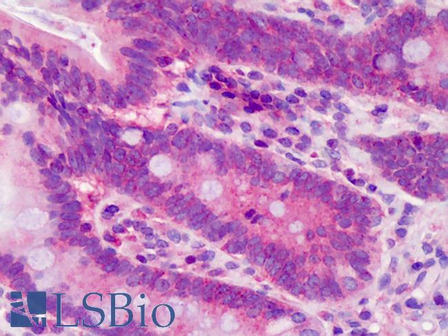 POLDIP3 / p46 Antibody - Anti-POLDIP3 / SKAR antibody IHC of human small intestine. Immunohistochemistry of formalin-fixed, paraffin-embedded tissue after heat-induced antigen retrieval. Antibody concentration 10 ug/ml.  This image was taken for the unconjugated form of this product. Other forms have not been tested.