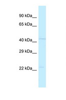 POLDIP3 / p46 Antibody - POLDIP3 / SKAR antibody Western blot of 3 Cell lysate. Antibody concentration 1 ug/ml.  This image was taken for the unconjugated form of this product. Other forms have not been tested.