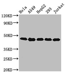 POLDIP3 / p46 Antibody - Positive Western Blot detected in Hela whole cell lysate, A549 whole cell lysate, HepG2 whole cell lysate, 293 whole cell lysate, Jurkat whole cell lysate. All lanes: POLDIP3 antibody at 3.2 µg/ml Secondary Goat polyclonal to rabbit IgG at 1/50000 dilution. Predicted band size: 47, 43 KDa. Observed band size: 47 KDa