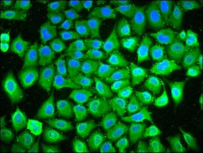 POLDIP3 / p46 Antibody - Immunofluorescence staining of Hela cells with POLDIP3 Antibody at 1:133, counter-stained with DAPI. The cells were fixed in 4% formaldehyde, permeabilized using 0.2% Triton X-100 and blocked in 10% normal Goat Serum. The cells were then incubated with the antibody overnight at 4°C. The secondary antibody was Alexa Fluor 488-congugated AffiniPure Goat Anti-Rabbit IgG(H+L).