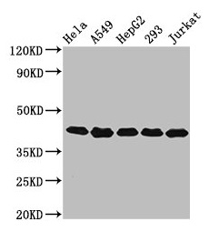 POLDIP3 / p46 Antibody - Western Blot Positive WB detected in: Hela whole cell lysate, A549 whole cell lysate, HepG2 whole cell lysate, 293 whole cell lysate, Jurkat whole cell lysate All lanes: POLDIP3 antibody at 3.2µg/ml Secondary Goat polyclonal to rabbit IgG at 1/50000 dilution Predicted band size: 47, 43 kDa Observed band size: 43 kDa