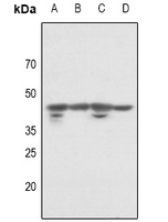 POLDIP3 / p46 Antibody - Western blot analysis of p46 expression in PC12 (A), CT26 (B), Hela (C), MCF7 (D) whole cell lysates.
