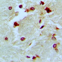 POLDIP3 / p46 Antibody - Immunohistochemical analysis of p46 staining in human brain formalin fixed paraffin embedded tissue section. The section was pre-treated using heat mediated antigen retrieval with sodium citrate buffer (pH 6.0). The section was then incubated with the antibody at room temperature and detected using an HRP conjugated compact polymer system. DAB was used as the chromogen. The section was then counterstained with haematoxylin and mounted with DPX.