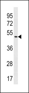 POLE2 Antibody - POLE2 Antibody western blot of HL-60 cell line lysates (35 ug/lane). The POLE2 antibody detected the POLE2 protein (arrow).