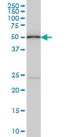 POLE2 Antibody - POLE2 monoclonal antibody (M01), clone 1A3 Western Blot analysis of POLE2 expression in HeLa NE.