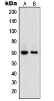 POLE2 Antibody - Western blot analysis of DNA Polymerase epsilon 2 expression in HL60 (A); HeLa (B) whole cell lysates.
