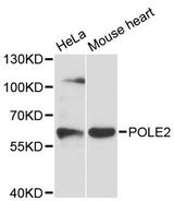 POLE2 Antibody - Western blot analysis of extracts of various cell lines, using POLE2 antibody at 1:3000 dilution. The secondary antibody used was an HRP Goat Anti-Rabbit IgG (H+L) at 1:10000 dilution. Lysates were loaded 25ug per lane and 3% nonfat dry milk in TBST was used for blocking. An ECL Kit was used for detection and the exposure time was 90s.