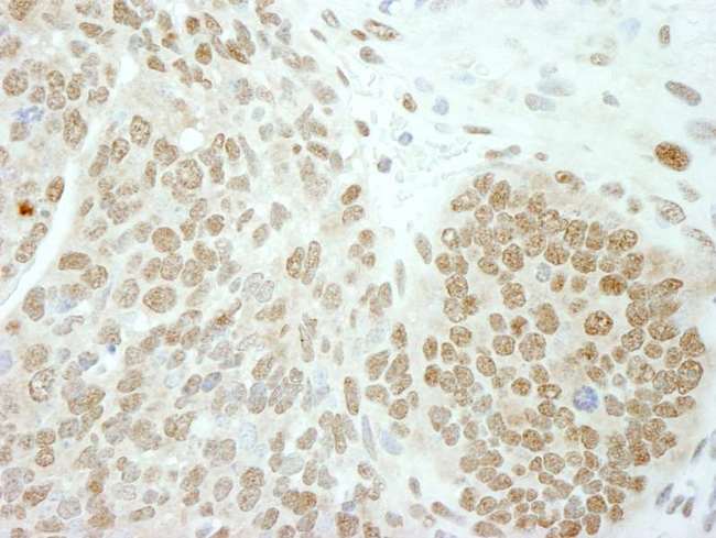 POLE3 / DNA Polymerase Epsilon Antibody - Detection of Mouse PolE3/p17 by Immunohistochemistry. Sample: FFPE section of mouse teratoma. Antibody: Affinity purified rabbit anti-PolE3/p17 used at a dilution of 1:100.