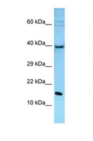 POLE3 / DNA Polymerase Epsilon Antibody - POLE3 antibody Western blot of Mouse Liver lysate. Antibody concentration 1 ug/ml.  This image was taken for the unconjugated form of this product. Other forms have not been tested.