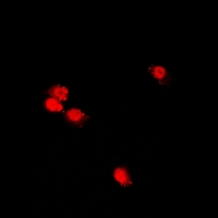 POLE3 / DNA Polymerase Epsilon Antibody - Immunofluorescent analysis of CHRAC17 staining in U2OS cells. Formalin-fixed cells were permeabilized with 0.1% Triton X-100 in TBS for 5-10 minutes and blocked with 3% BSA-PBS for 30 minutes at room temperature. Cells were probed with the primary antibody in 3% BSA-PBS and incubated overnight at 4 deg C in a humidified chamber. Cells were washed with PBST and incubated with a DyLight 594-conjugated secondary antibody (red) in PBS at room temperature in the dark.