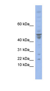 POLE4 / p12 Antibody - POLE4 antibody Western blot of COLO205 cell lysate. This image was taken for the unconjugated form of this product. Other forms have not been tested.