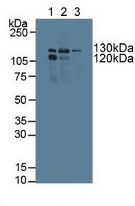 POLG Antibody - Western Blot; Sample: Lane1: Human K562 Cells; Lane2: Human Jurkat Cells; Lane3: Human A549 Cells.