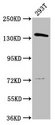 POLG Antibody - Positive Western Blot detected in 293T whole cell lysate. All lanes: POLG antibody at 4.7 µg/ml Secondary Goat polyclonal to rabbit IgG at 1/50000 dilution. Predicted band size: 140 KDa. Observed band size: 140 KDa