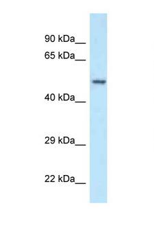 POLG2 Antibody - POLG2 antibody Western blot of Fetal Kidney lysate. Antibody concentration 1 ug/ml.  This image was taken for the unconjugated form of this product. Other forms have not been tested.