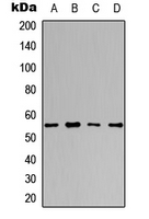 POLG2 Antibody - Western blot analysis of DNA Polymerase gamma 2 expression in A549 (A); HeLa (B); NS-1 (C); H9C2 (D) whole cell lysates.