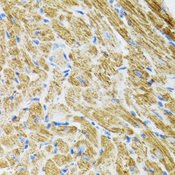 POLG2 Antibody - Immunohistochemistry of paraffin-embedded rat heart tissue.