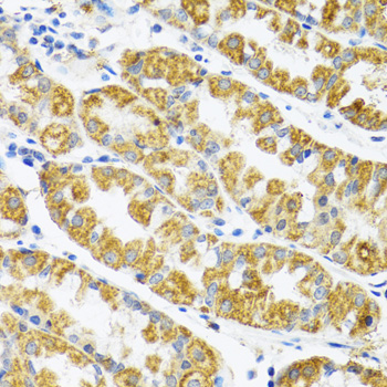 POLG2 Antibody - Immunohistochemistry of paraffin-embedded human stomach tissue.