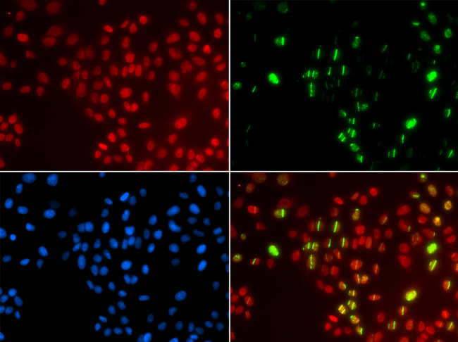 POLH / DNA Polymerase Eta Antibody - Immunofluorescence analysis of GFP-RNF168 trangenic U2OS cells.